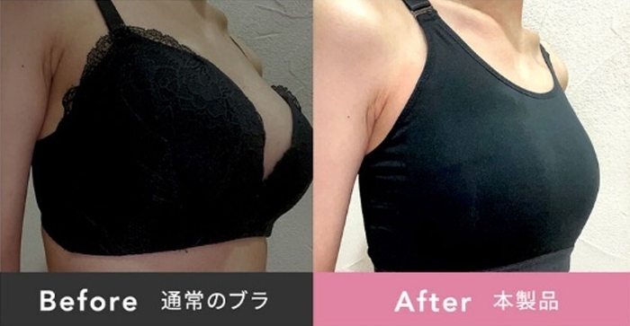 Before/After
