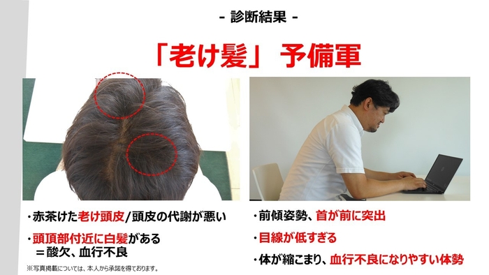 オンライン環境下での“老け髪”対策ミニ講座 講演スライド2