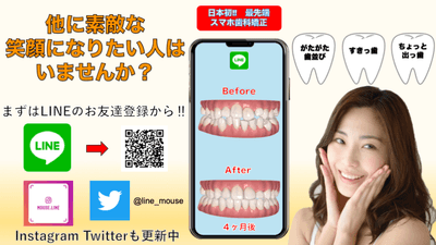 マウスライン1