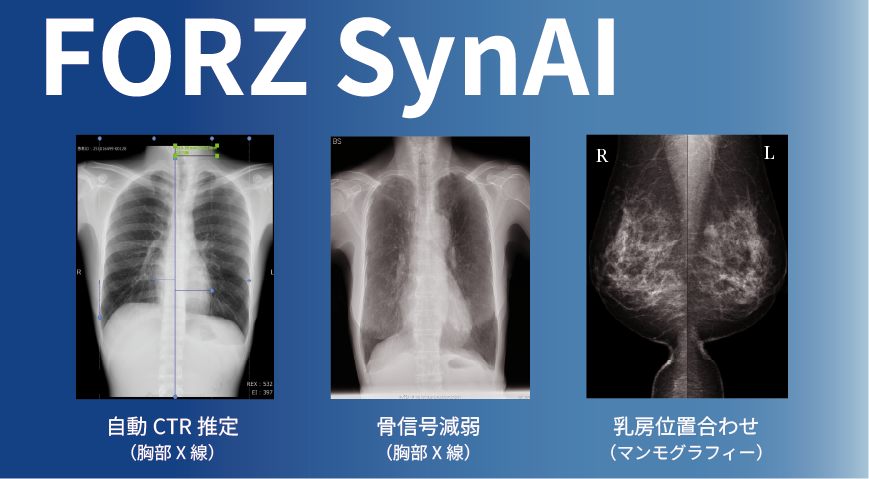 【医療DX】医師の負担を軽減。AI画像解析プラットフォーム「FORZSynAI」リリース