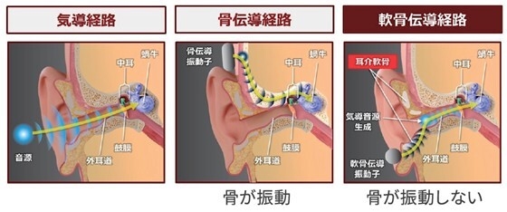 軟骨伝導と他の伝導の違い