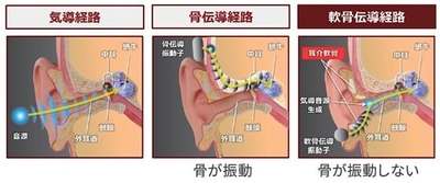 軟骨伝導と他の伝導の違い