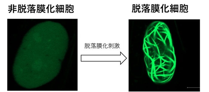 図1：脱落膜化における核内アクチン集合体形成　アクチンをGFPタンパクで標識することで、核内アクチンを可視化できる子宮内膜間質細胞を樹立した。この細胞に脱落膜化刺激を加え脱落膜化を誘導したところ、線状のGFP構造（アクチン凝集体）が出現した。