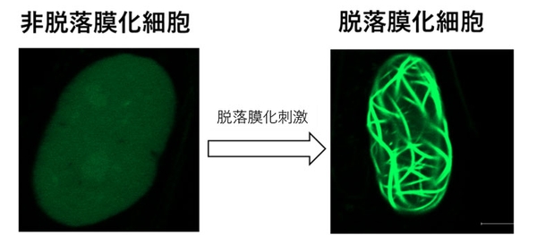 図1:脱落膜化における核内アクチン集合体形成 アクチンをGFPタンパクで標識することで、核内アクチンを可視化できる子宮内膜間質細胞を樹立した。この細胞に脱落膜化刺激を加え脱落膜化を誘導したところ、線状のGFP構造(アクチン凝集体)が出現した。