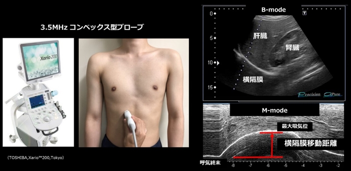 横隔膜移動距離を測定する様子